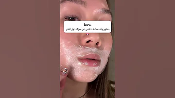 علاج تصبغات واستمرار حول الفم 
