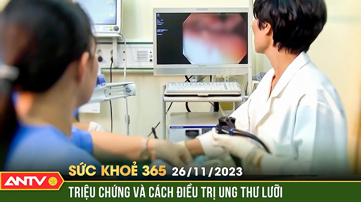 Ung thư lưỡi có biểu hiện như thế nào năm 2024