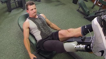 Stay Healthy (Life After Amputation) | Springer Prosthetic & Orthotic Services