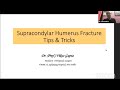 Dr vikas gupta  supracondylar humerus fracture tips  tricks