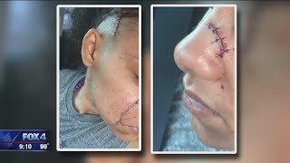 Dallas stabbing victims say they were targeted for being gay screenshot 5