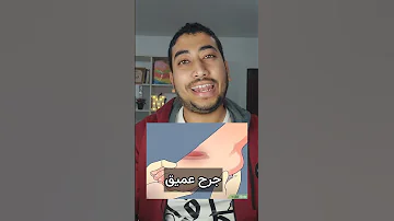 لو حصلك النوع ده من الجروح روح المستشفى فورا 