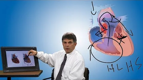 Pediatric Playbook: Congenital Heart Defect Hypopl...