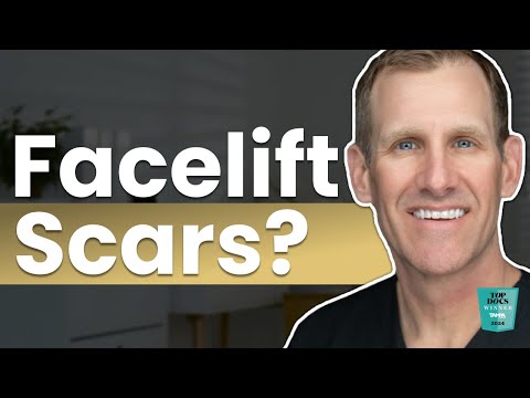 Do Facelifts Leave Scars? | How to Minimize Facelift Incisions & Heal Flawlessly
