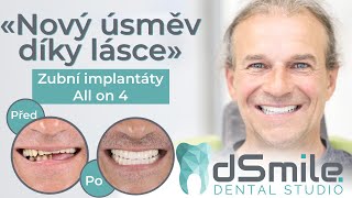 How does dental implantation work? Permanent teeth in Prague