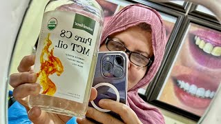 صيام الماء اليوم الثالث تاريخ ٢٠ ٣ ٢٠٢٣ تجربه صيام الماء تجارب صيام الماء   صيام الماء
