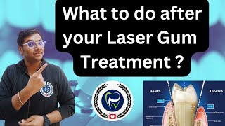 Dr Rudra Mohan | What Instructions to Follow after your Laser Gum treatment (LANAP Instructions)