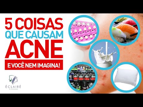 Vídeo: O Café Causa Acne: Cística, Efeitos Na Pele, Açúcar E Hormônios