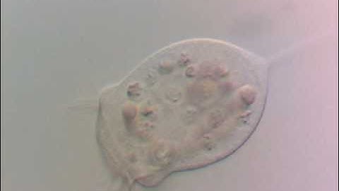 Vorticella processed by Helicon Focus to produce 3D