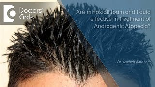 Are minoxidil foam and liquid effective in treatment of Androgenic Alopecia? - Dr. Sachith Abraham