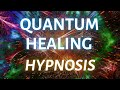 Accessing higher wisdom quantum healing hypnosis session