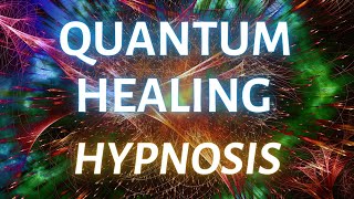 Accessing Higher Wisdom: Quantum Healing Hypnosis Session