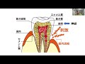 実は怖い！知覚過敏によって歯がダメになる２つの理由とは