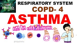 Chronic Obstructive Pulmonary Disease Part 4: Asthma  Etiopathogenssis & Pathology