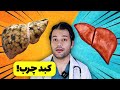 10 علامت کبد چرب که لازمه حتما بدونید درمان کبد چرب 10 علامت کبد چرب که لازمه حتما بدونید درمان کبد چرب