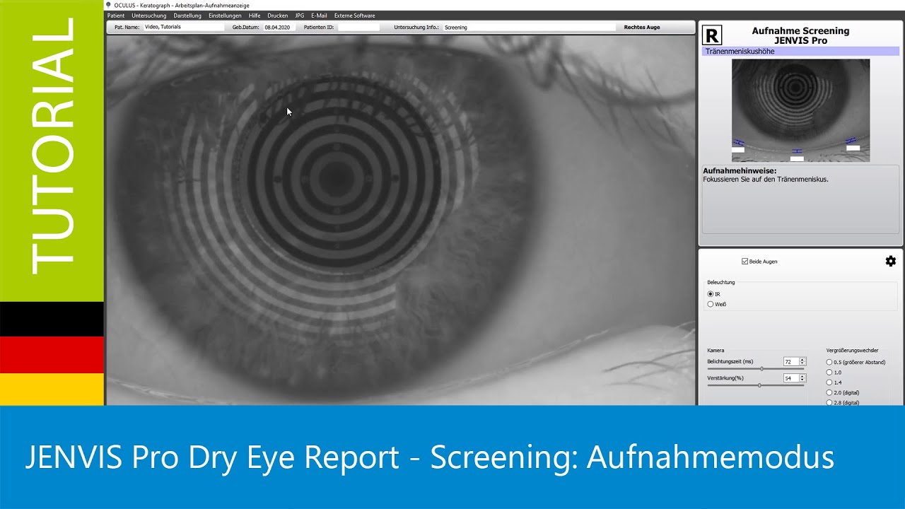 Jenvis Report.pdf JENVIS Pro Dry Eye Report - Screening: Aufnahmemodus - YouTube