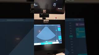 SonoSite Learn
