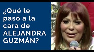 Rostro De Alejandra Guzmán Qué Le Pasó?