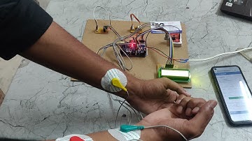HVS-3548. IOT Based Heart Monitoring System using ECG Thingspeak