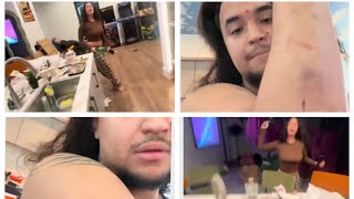 Lexi2Legit Beats On Her Baby Daddy Saweb And Leaves Him Injured With Bruses