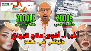 Ruxotop - Opzelura رسميا ... العلاج البيولوجي للبهاق ، موجود في مصر - و ازاي تقدر تشتريه؟!