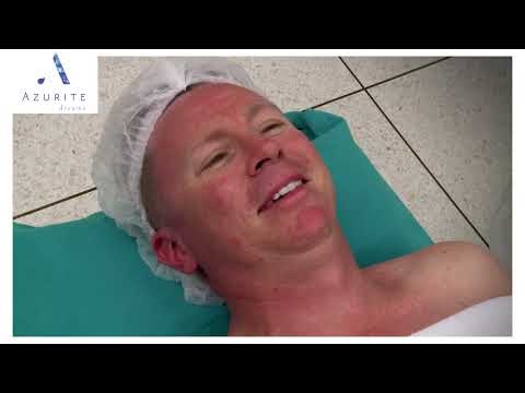 Justin's Facelift filmed by international producers | Thailand Surgery | Azurite Medical & Wellness
