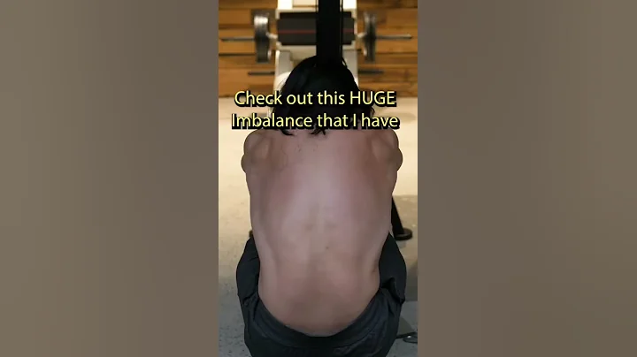 MUSCLE IMBALANCES - I freaked out when I first saw my Spine in an X-Ray 😅😅 - DayDayNews