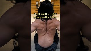 MUSCLE IMBALANCES - I freaked out when I first saw my Spine in an X-Ray 