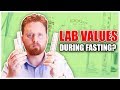 Fasting Results: Lab Values During Fasting