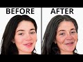 TikTok's New Aging Filter is Insane! | Plastic Surgeon Reacts