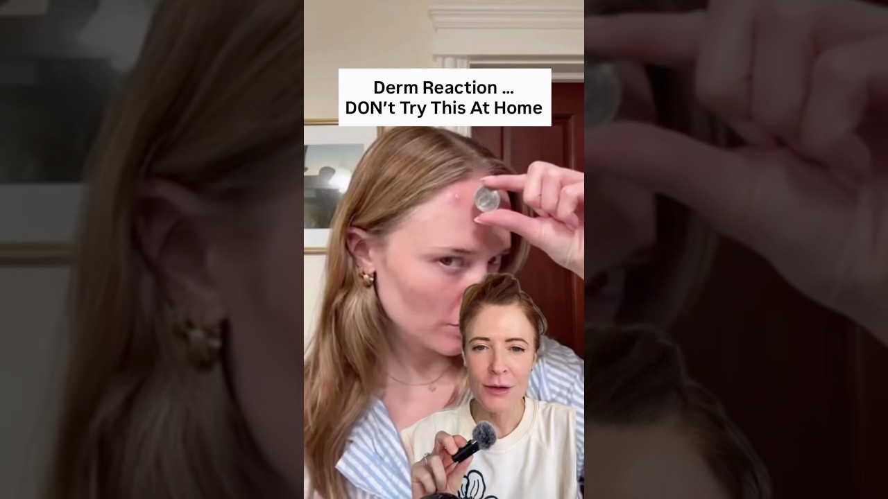 Derm Reaction: Don’t Try This At Home