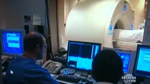 PECARN OBSERVATION FOR HEAD INJURY ON CBS NEWS