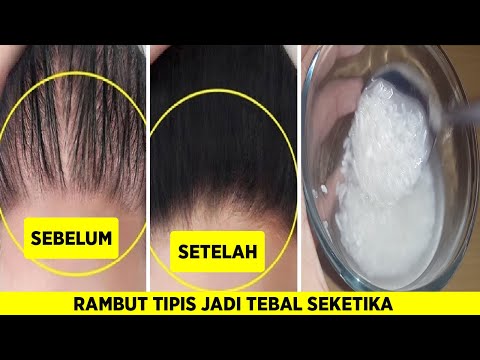 Video: ❶ Cara Menjadikan Rambut Lebih Tebal Di Rumah