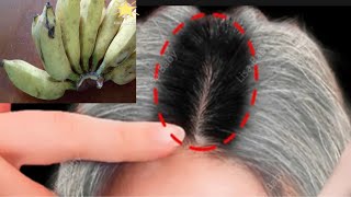 ปิดผมขาว แก้ผมหงอก ไร้สารเคมี White Hair Turn To Black Hair Naturally With Banana | White hair dye