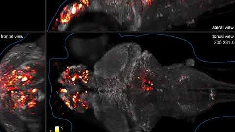 Time Lapse Zebrafish Neural Activity by Dr Phillip Keller