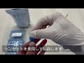 新型コロナウイルス抗体検出キットのご紹介 - ヤマト科学