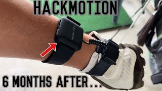 Hackmotion Before | After