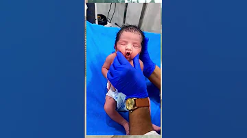 Newborn Baby Moro Reflex Test Shorts Feed Baby Shorts Babycare Shorts Babyshorts 