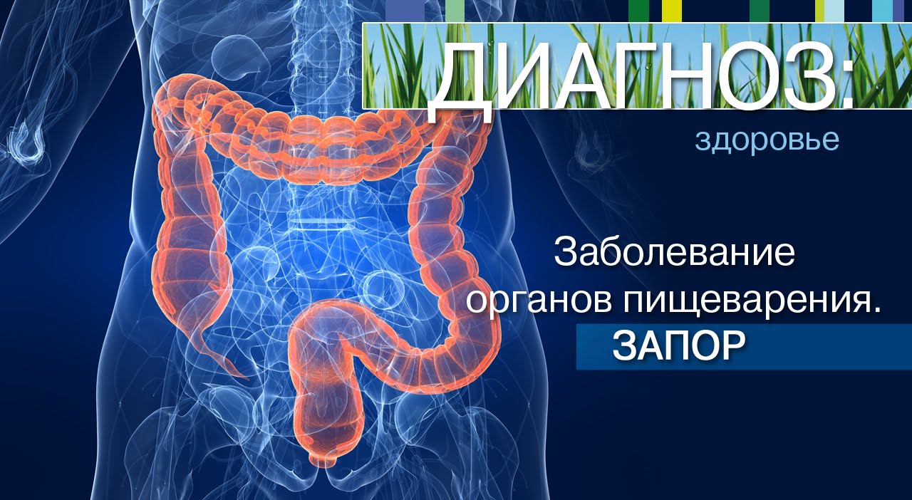 Заболевание органов пищеварения. Запор. | Диагноз: здоровье