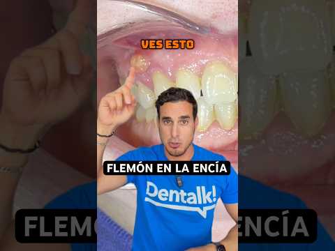 Así se quita un FLEMÓN DENTAL 😱 El error que puede empeorar la infección