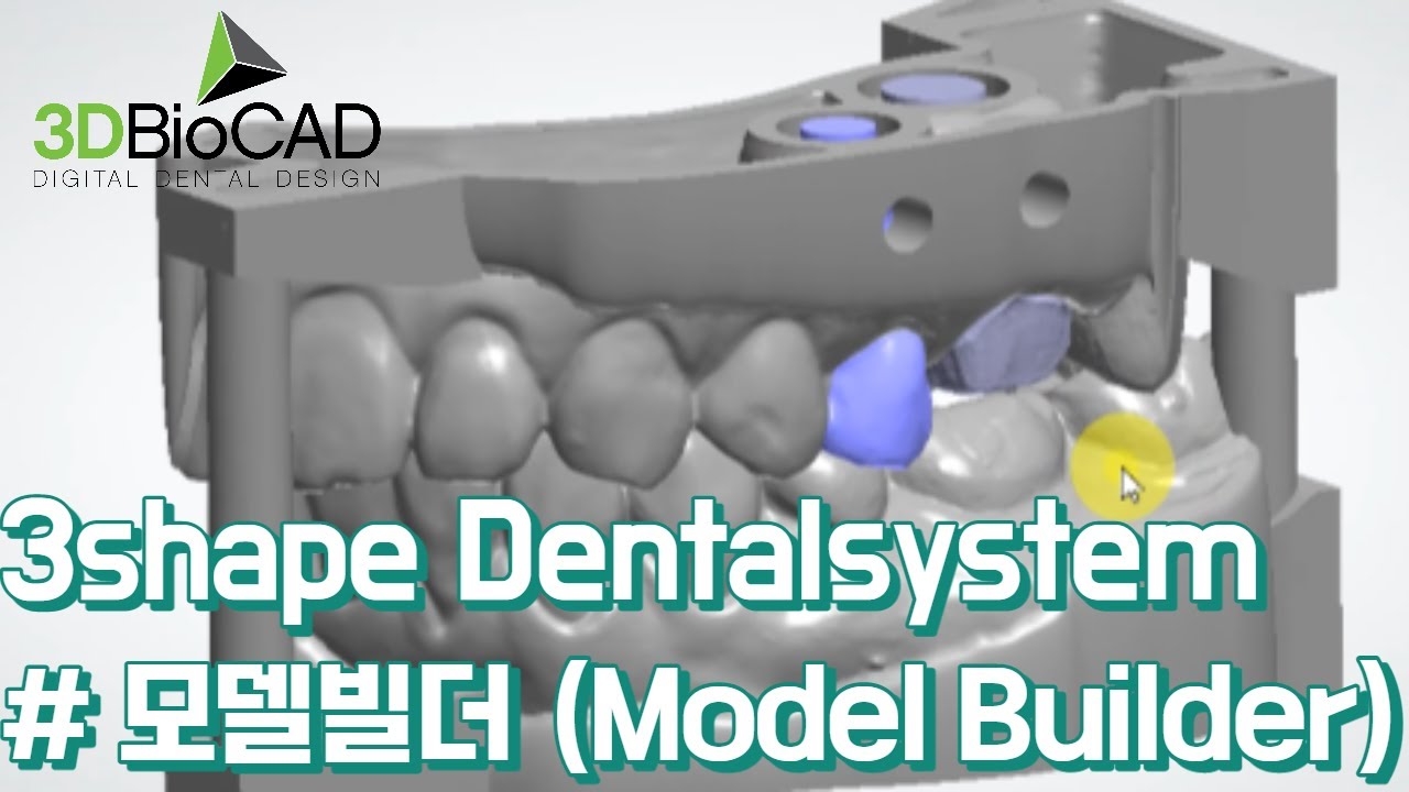 3shape Dentalsystem 모델빌더(Model Builder) 디자인 YouTube