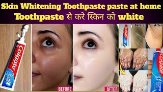 Toothpaste for neck Whitening | How to get rid of dark neck |Skin whitening toothpaste home remedies