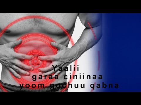 Dhukkuba Garaa Ciniina Yaalamuuf Yoom Mana Yaalaa Dhaquu Qabna Yoko Doctor Dr Daawwit Milkiyaas