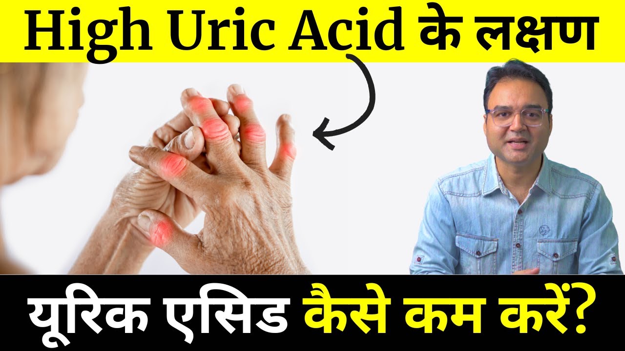 यूरिक एसिड बढ़ने के लक्षण, नार्मल स्तर और उपाय  | यूरिक एसिड बढ़ने पर क्या खाना चाहिए और क्या नहीं?