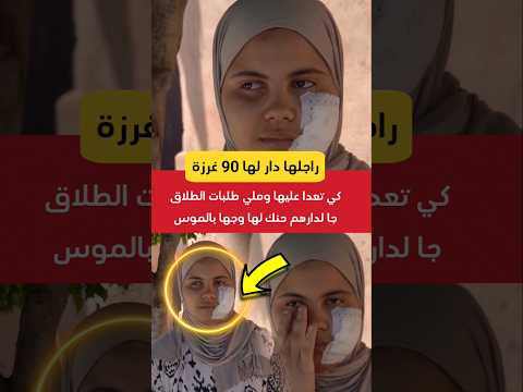 دار لها 90 غرزة فوجها حيت مابغاتش طلق منو