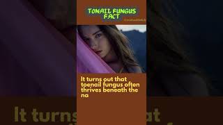 Natural Remedy: Toe Nail Fungus Cure onychomycosis howtocurenailfungus fungalinfection