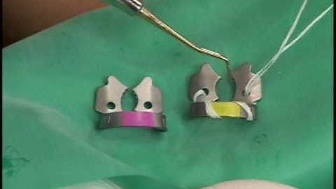 Clamp Selection and Placement