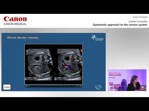 ISUOG 2019   Julene Carvalho on a systemic approach to the venous system