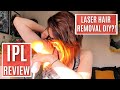 LASER HAIR REMOVAL AT HOME | IPL Review: Braun Silk Expert Pro 5