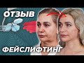 Отзыв. Фейслифтинг. Хирург Блохин С.Н.